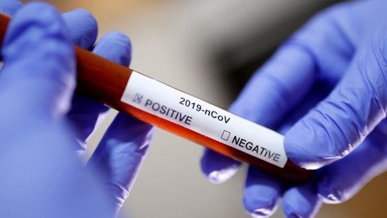 Coronavirus, l'Oms: "Avviamo uno studio su trattamenti usati nel mondo"