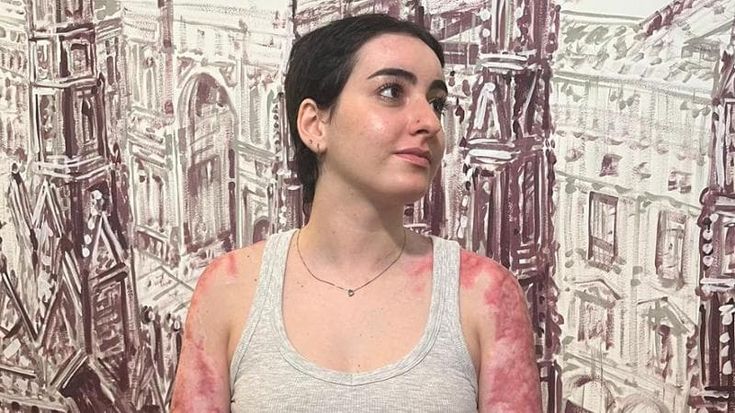 Sofia, sopravvissuta alla strage di Crans: “L’uscita d’emergenza era chiusa con catena e lucchetto”