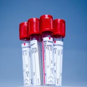 Virus dell'Epatite E per un italiano su dieci