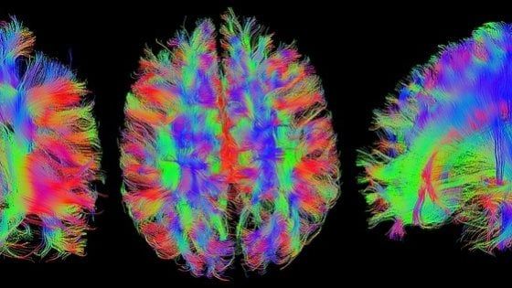 Tumore al cervello, quanto conta la differenza di genere