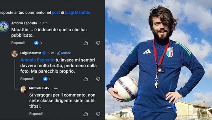 “Sei tanto brutto”. L’onorevole Marattin offende cantautore di Matera con segni chirurgici sul volto