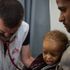 Yemen, un anno dopo l’offensiva di Hodeidah i feriti di guerra stanno aumentando 