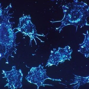 Tumori: "Ecco come nasce l'anarchia cellulare del cancro"