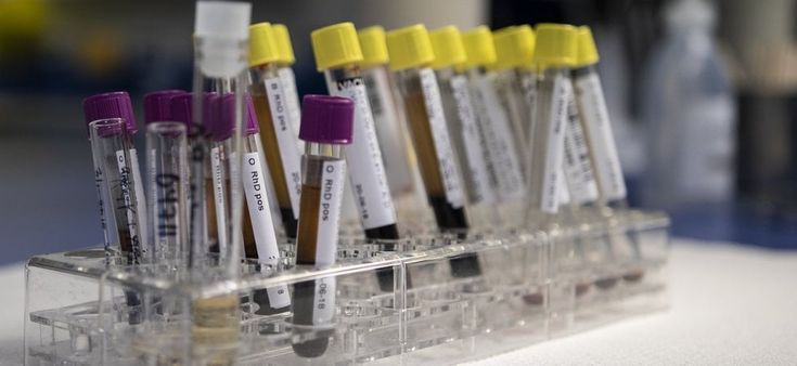 Al via una nuova sperimentazione per CAR-T contro leucemia mieloide acuta e mieloma multiplo