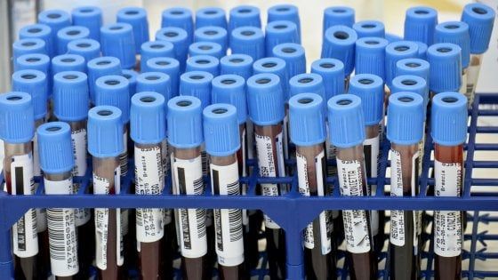 Coronavirus: positivo un tesserato della Cavese