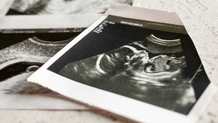 In Piemonte la Regione stanzia 400mila euro per le donne che rinunciano ad abortire
