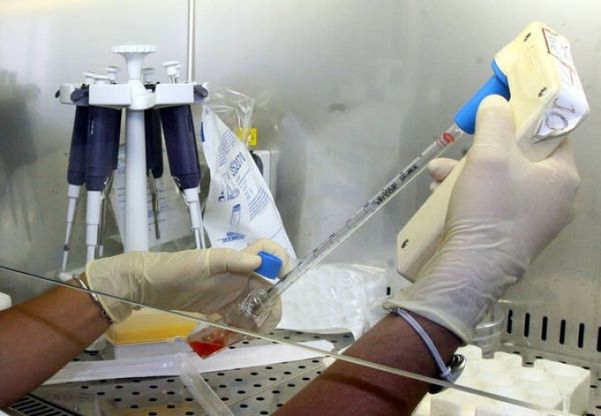 Diabete, staminali in grado di produrre insulina 'ricavate' da cellule di pelle del malato