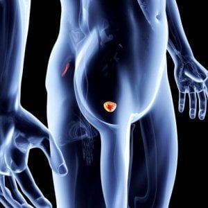 Tumore alla vescica, per il 68% degli italiani è inguaribile ma la prevenzione può fare molto