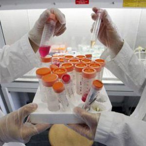"Terapia genetica rende cecità ereditaria reversibile"