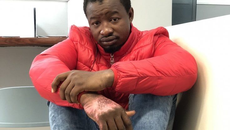 Bimbi morti sul barchino, il racconto di Daouda: "Li ho visti mentre bruciavano. Ho salvato la mamma e altri due uomini"