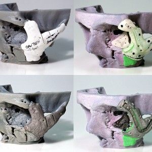 Due bimbi con problemi polmonari  salvati dalla stampante 3D: realizzate vie aeree artificiali