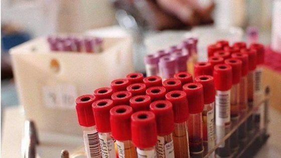 Bologna, donazioni di sangue diminuite del 20%