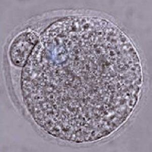Gameti da cellule della pelle, funzionano i primi test  per risolvere infertilità