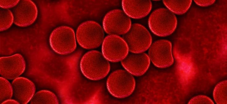 Emofilia, il sangue di Luca e la normalità di un'anomalia 