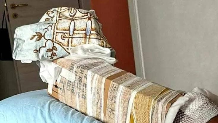 Un cartone per immobilizzare la gamba fratturata, revocata la multa alla medica che intervenne