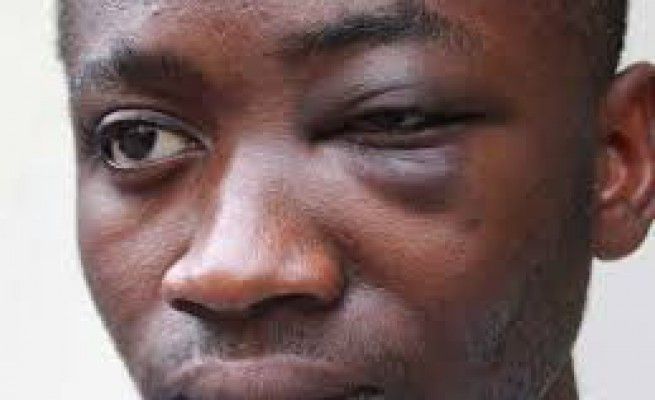 Caso Bonsu, sentenza d'appello<br />attesa nel pomeriggio 