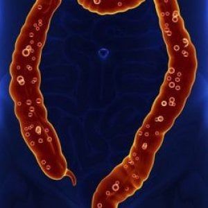 Tumore del colon retto: la terapia target funziona anche nella vita reale