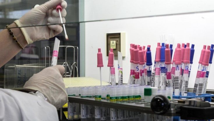 Covid: cresce l'antibioticoresistenza nelle terapie intensive