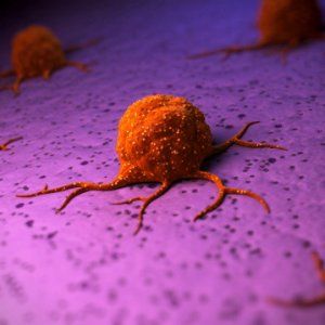 Tumori rari crescono e la sanità italiana è in ritardo