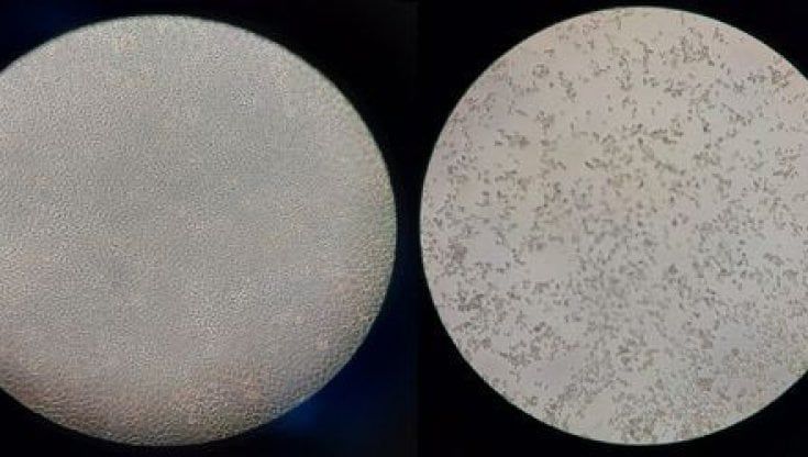 Coronavirus, i ceppi isolati in Puglia sono 30 ma è allarme per la variante inglese: "Alziamo la guardia"