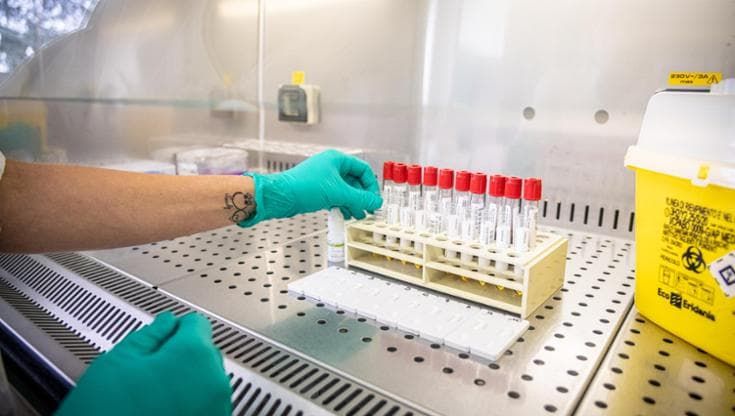 Salento, troppi campioni da analizzare e pochi tecnici: i laboratori d’analisi rischiano lo stop