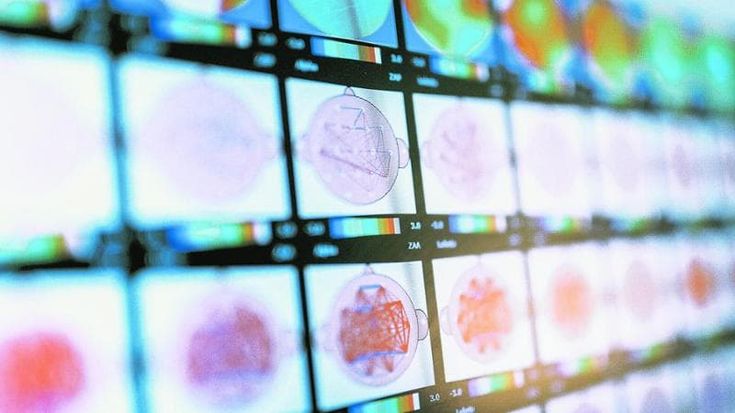 Il dottor AI è già in corsia, ma non potrà mai lavorare senza medici