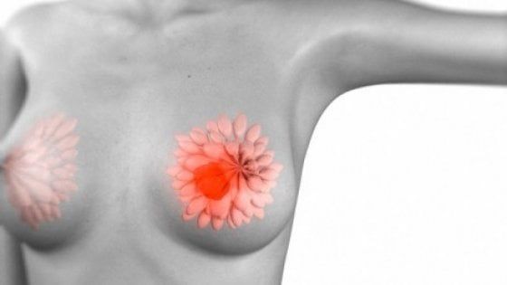 "Le Breast Unit siano operative in tutta la penisola"