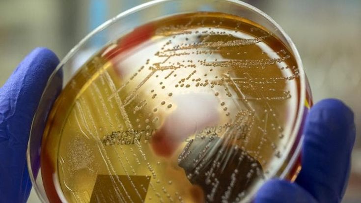 Quinta malattia, streptococco e pertosse, la primavera record delle infezioni. Ecco cosa c’è da sapere su rischi, prevenzione e cure
