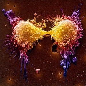 Terapie oncologiche, seguire i mutamenti cellulari per neutralizzare meglio i tumori