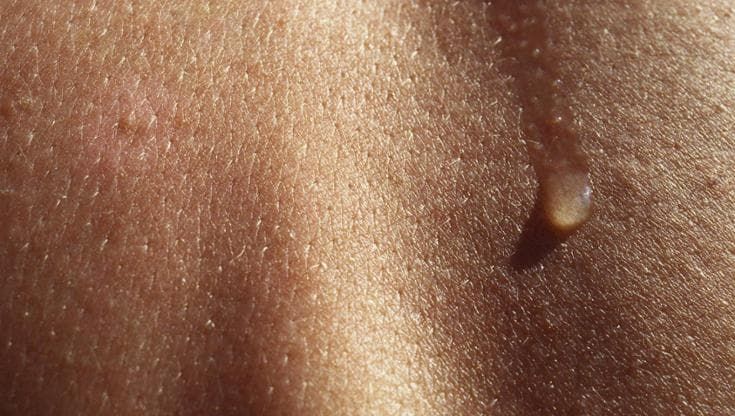 Addio agli aghi? Il sensore che legge la salute nel sudore