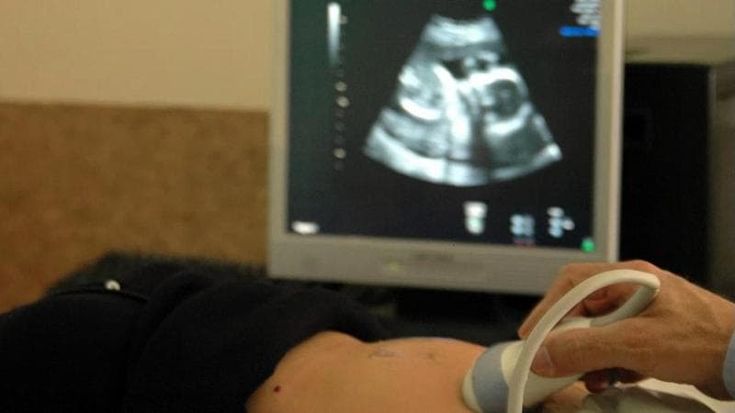 “I miei figli nati morti per l’amniocentesi. Per l’esame solo un po’ di disinfettante”