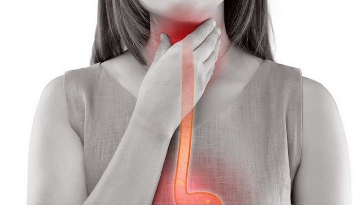 Tumore dell’esofago, sì all’immunoterapia per prevenire le recidive