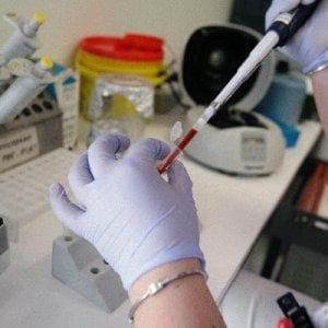 Secondo caso di "West nile" nel livornese