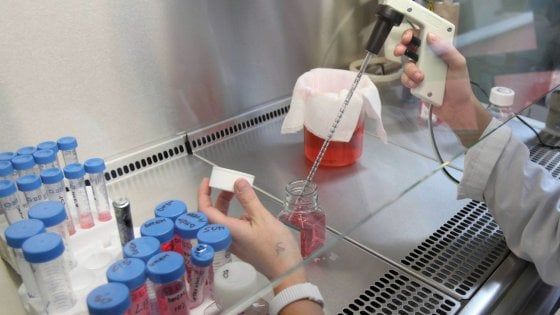 Cancro a colecisti, ricercatrice precaria scopre meccanismo che blocca i rifornimenti alle cellule malate