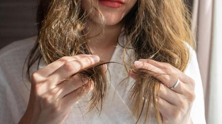 Sbalzi termici e stress, quando il clima impazzito fa cadere i capelli