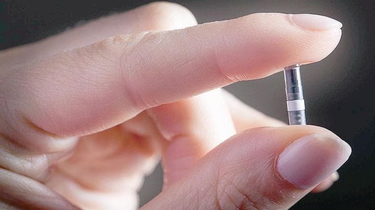 Vivere con il diabete nell’era 2.0 Il monitoraggio è sottopelle e i microinfusori sono elettronici