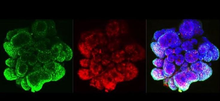 Il cancro in provetta: a Milano si studiano gli “organoidi tumorali” per personalizzare la cura
