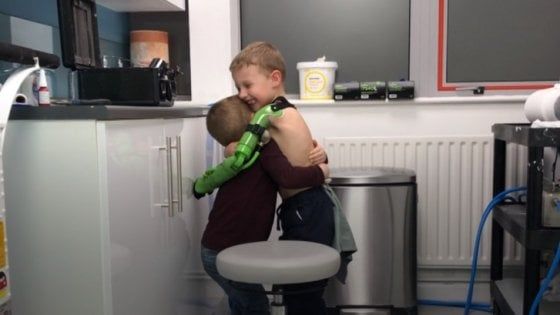 Gb, il regalo di Natale per Jacob: un braccio bionico "come Hulk. Ora può abbracciare il fratellino"