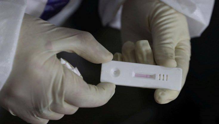 Covid, dagli atenei di Parma e Ferrara due molecole contro gli effetti gravi