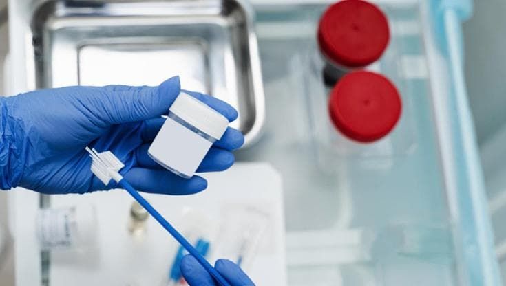 Tre pap test negativi ma aveva un carcinoma: muore a 47 anni. Il laboratorio paga 300mila euro