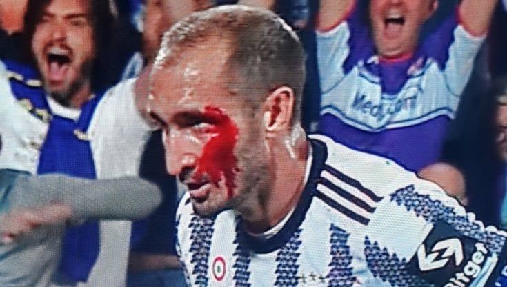 Chiellini insanguinato, anche l'ultima partita col turbante