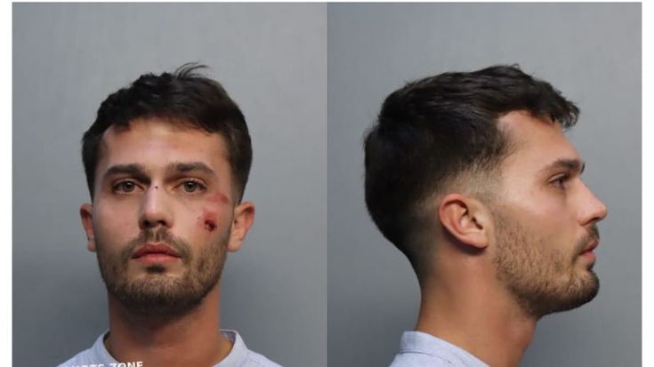 Miami, studente italiano arrestato e legato mani e piedi in cella per 13 minuti. La mamma: “Tortura, vogliamo giustizia”. Farnesina: “Trattamento particolarmente violento”