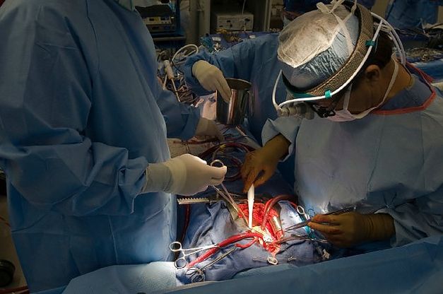 Padova, cuore bionico in un giovane già trapiantato: intervento senza precedenti