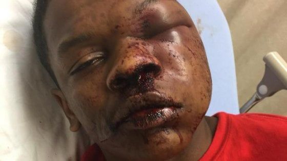 Violenze della polizia contro i neri, madre denuncia: "Hanno massacrato mio figlio ammanettato"