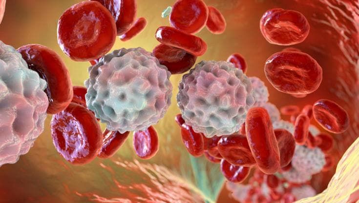 Linfoma diffuso a grandi cellule B, una nuova opzione per i casi più gravi