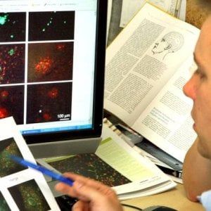 Alzheimer, ecco il 'punto debole' del cervello dove attacca la malattia