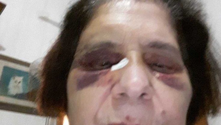 "Quell'uomo mi ha pestata a sangue e io non mi sento più una persona libera"