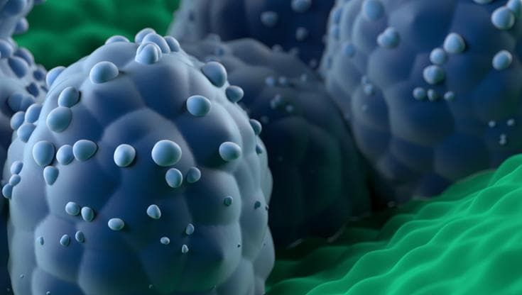 Tumore alla prostata, una nuova strategia per ridurre le biopsie inutili