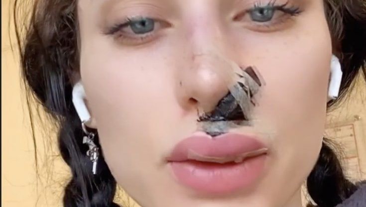 La youtuber Greta Menchi aggredita da un cane: "I suoi denti sembravano bisturi"
