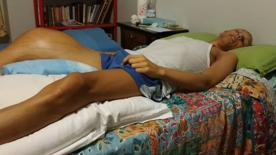 Catania, la mobilitazione per far curare Luca: in campo Fiorello e la Columbia University
